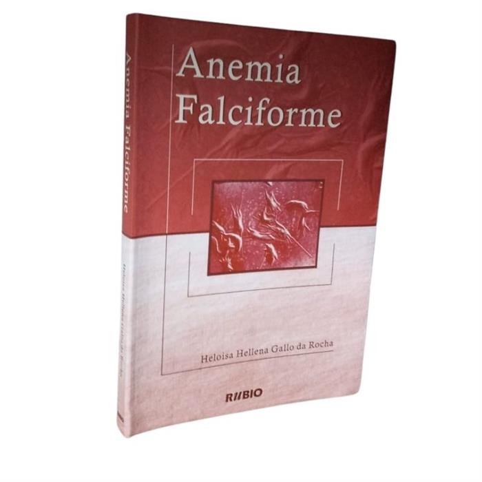 Anemia Falciforme